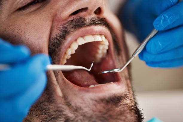 Best Pediatric Emergency Dentist in Charter Oak, CA