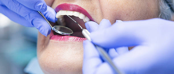 Best Emergency Dental Care for Broken or Chipped Teeth in Charter Oak, CA